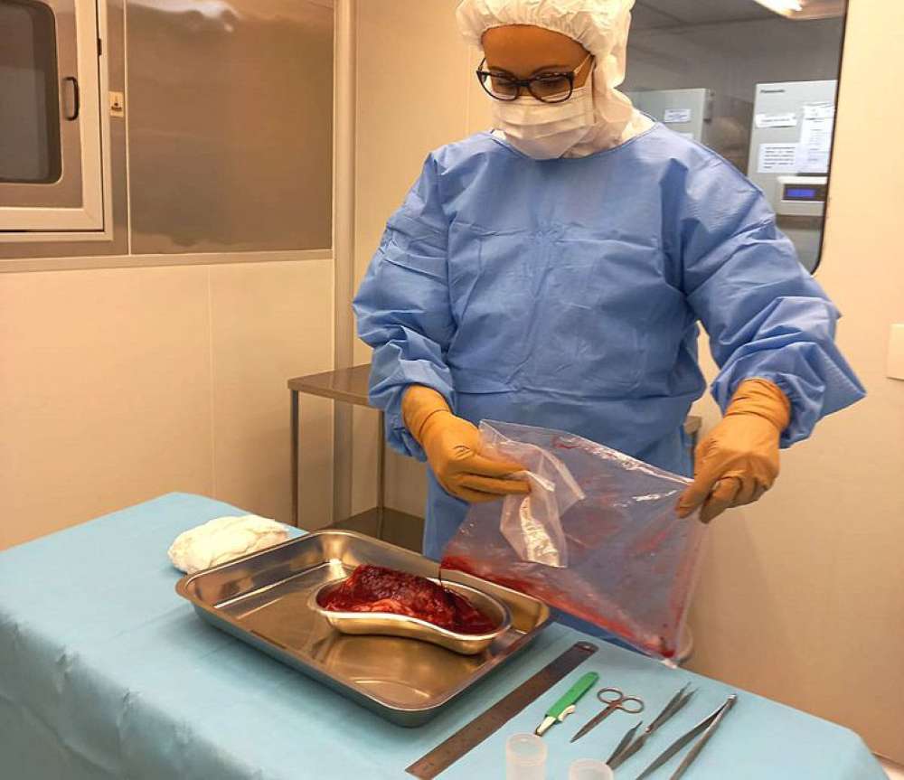 Pesquisa desenvolve curativos biológicos à base de placenta